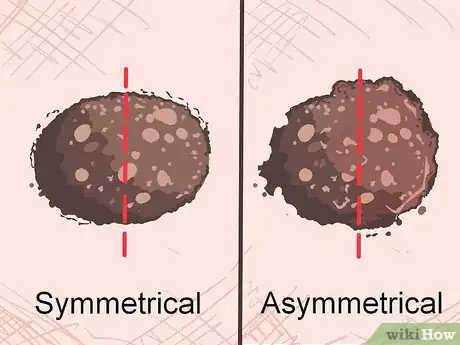 Image titled Recognize Melanoma Step 1