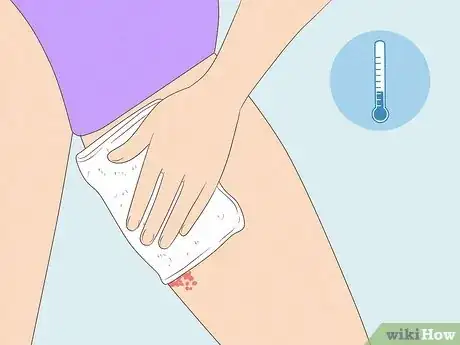 Image titled Get Rid of a Rash Between Your Legs Step 3