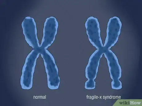 Image titled Recognize the Symptoms of Fragile X Syndrome Step 6