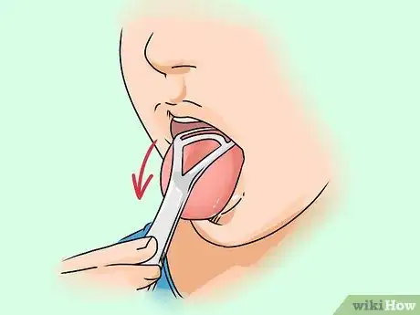 Image titled Get Rid of White Tongue Step 2