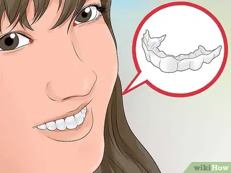 Image titled Prepare for Getting Braces Removed Step 10