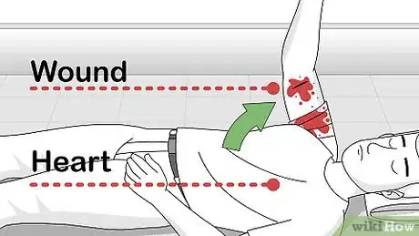 Image titled Attend to a Stab Wound Step 10