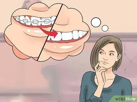Image titled Prepare on the Day You Get Braces Step 1