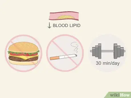 Image titled Diagnose a Fatty Liver Step 16