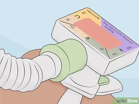 Image titled Measure an ET Tube Step 13