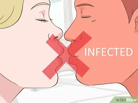 Image titled Prevent a Cold Sore from Forming Step 1