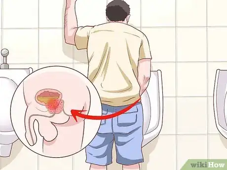 Image titled Improve Prostate Health Step 14