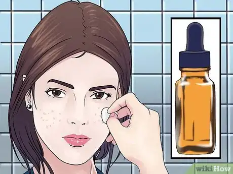 Image titled Prevent Acne Scars Step 16