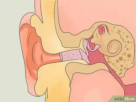 Image titled Identify Swimmer's Ear Step 11