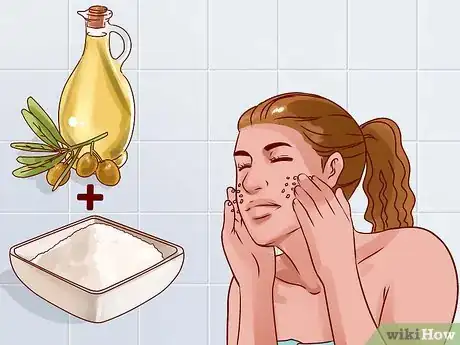 Image titled Get Rid of a Deep Pimple Step 18