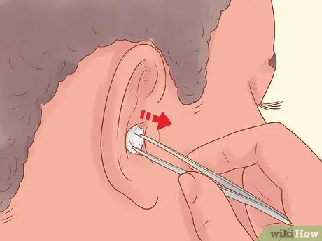 Image titled Remove Something Stuck in a Child's Ear Step 3