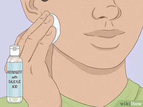 Image titled Get Rid of a Zit Overnight Step 6