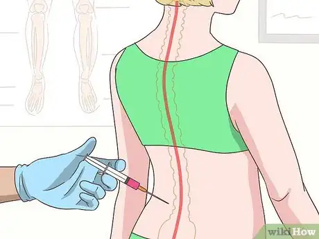 Image titled Get Rid of Back Pain Step 11