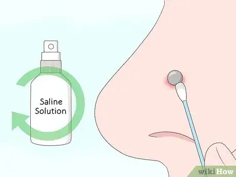 Image titled Heal a Nose Ring and Take Care of Infections Step 7