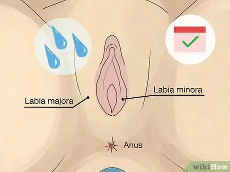 Image titled Control Vaginal Discharge Step 3