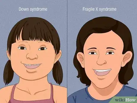 Image titled Recognize the Symptoms of Fragile X Syndrome Step 9