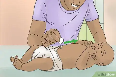 Image titled Clean an Umbilical Cord Stump on a Newborn Baby Step 4