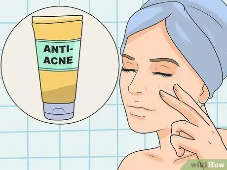 Image titled Get Rid of Red Acne Marks Step 2