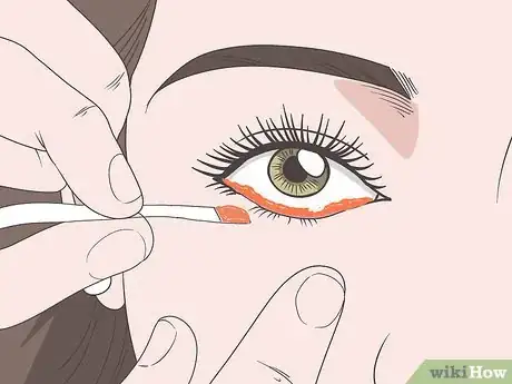 Image titled Treat Eyebrow and Eyelash Lice Step 7