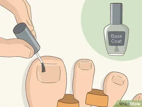 Image titled Give Yourself a Pedicure Using Salon Techniques Step 16