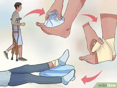 Image titled Treat a Sprain During First Aid Step 1