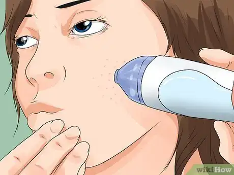 Image titled Use a Blackhead Vacuum Step 3