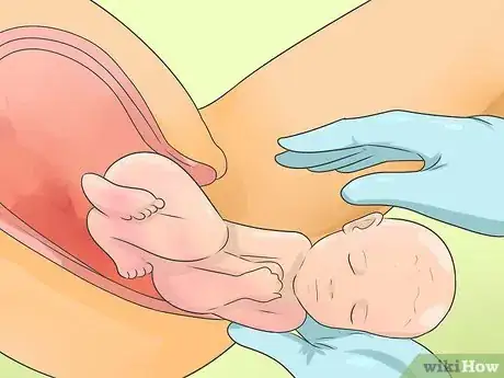 Image titled Deliver a Baby Step 10