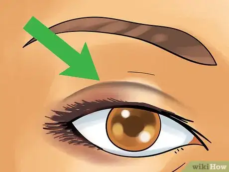 Image titled Make a Double Eyelid Step 13