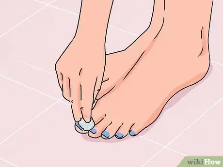 Image titled Make Your Feet Beautiful Step 14