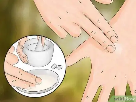 Image titled Get Rid of Bug Bites Step 10