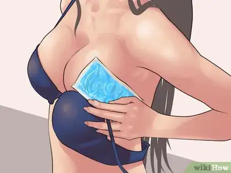 Image titled Get Rid of a Rash Under Breasts Step 3