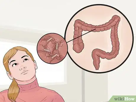 Image titled Distinguish Ulcerative Colitis from Similar Conditions Step 10