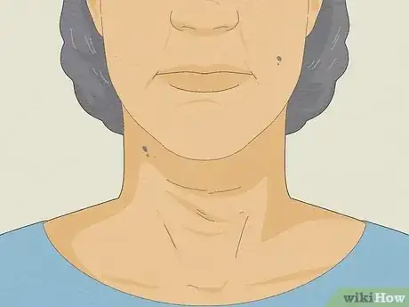 Image titled Get Rid of Neck Lines Step 1