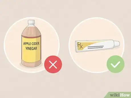 Image titled Use Apple Cider Vinegar for Psoriasis Step 3