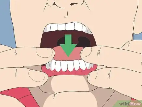 Image titled Wear Dentures Step 3