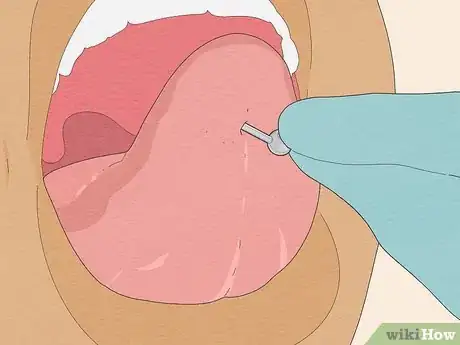 Image titled Pierce Your Own Tongue Step 10