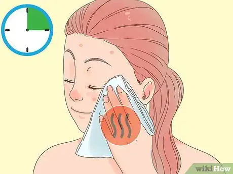 Image titled Remove the Redness of a Pimple Step 5