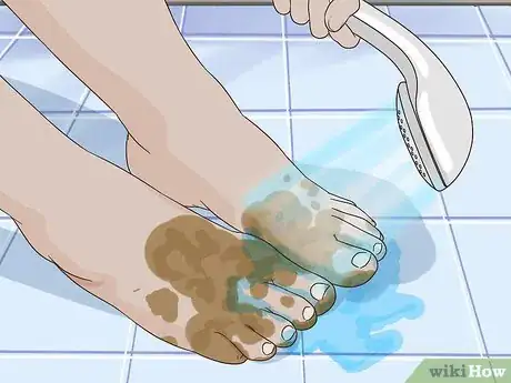 Image titled Remove Stains from Your Feet Step 1