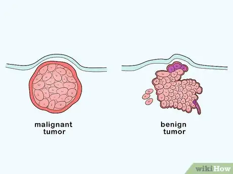 Image titled Treat Tumors in Amazon Parrots Step 1