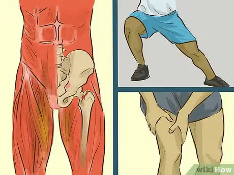 Image titled Treat a Groin Injury Step 7