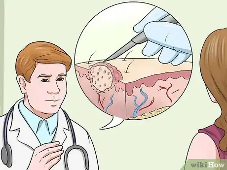 Image titled Get Rid of Warts on Hands Step 13