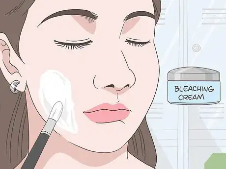 Image titled Treat Vitiligo Step 11