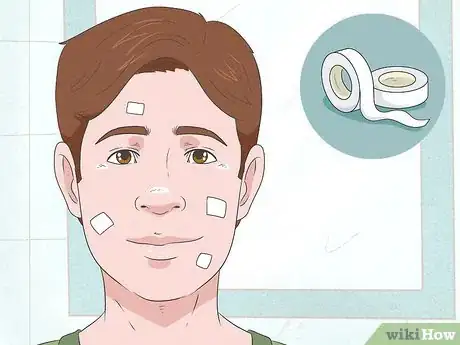 Image titled Heal Your Face After Picking Step 9