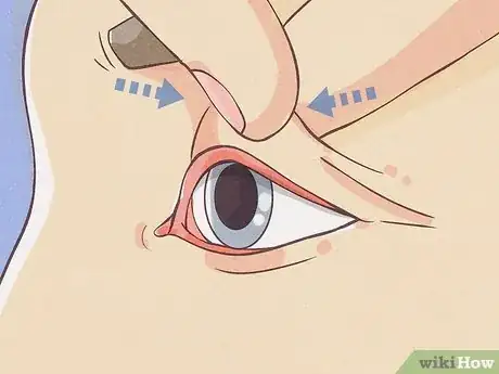 Image titled Flip Eyelids Inside Out Step 8
