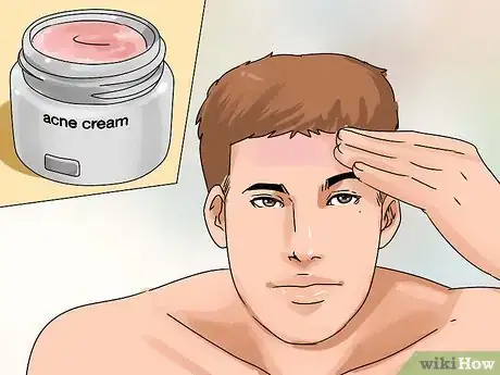 Image titled Remove a Blackhead from Your Forehead Step 10