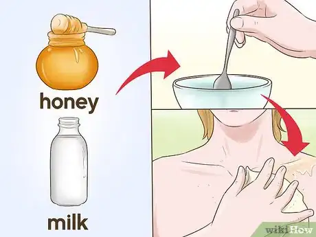 Image titled Get Rid of Acne Scars on Your Chest Step 13