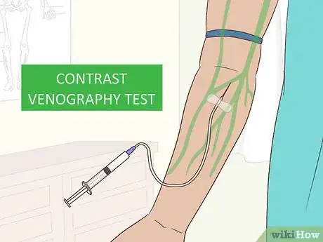 Image titled Treat DVT in Your Arm Step 12