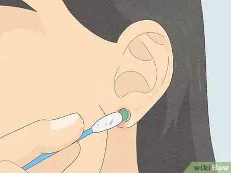 Image titled Clean Your Ear Piercing Step 3