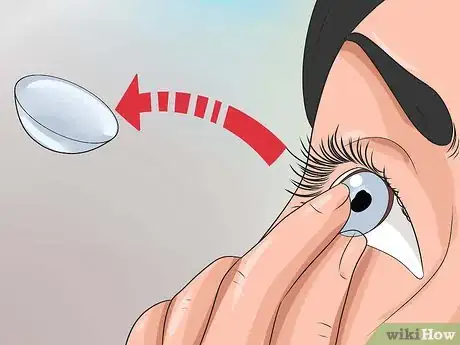 Image titled Get Rid of Pink Eye Fast Step 7