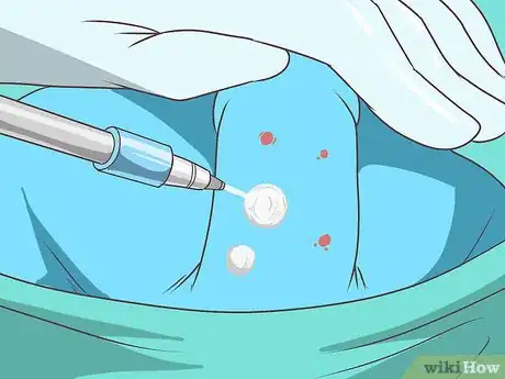 Image titled Get Rid of Genital Warts Step 10